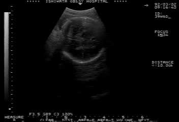 isato920303.jpg