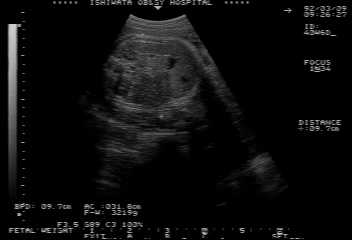 isato920309.jpg